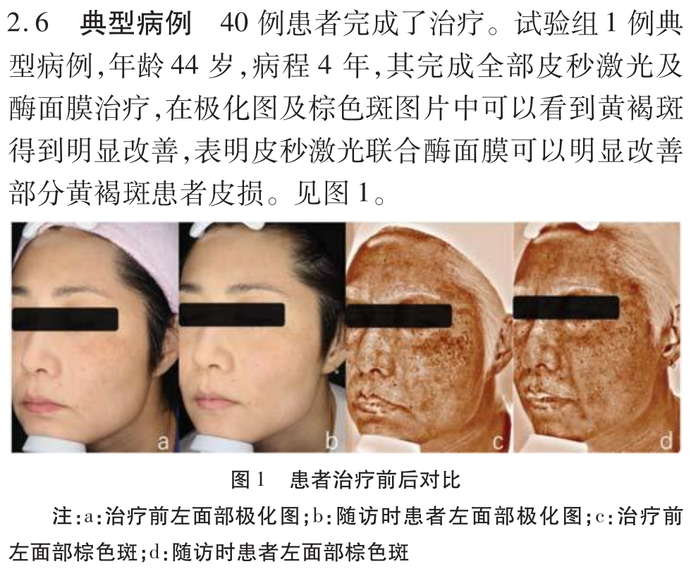 刷酶报告